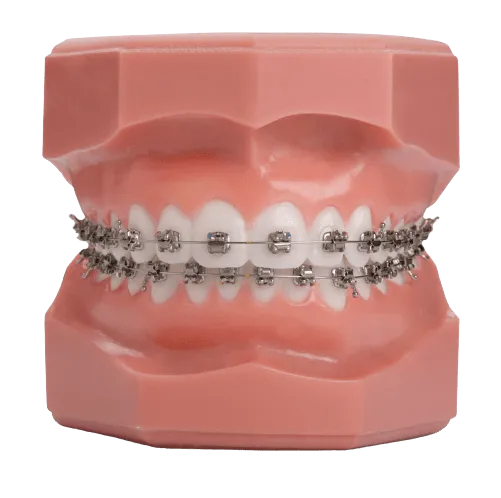 Self-Ligating Brackets